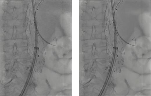 左がOPTIQ AIが無い状態の画像。右がOPTIQ AIがあるときの画像で、より鮮明な写真となっている