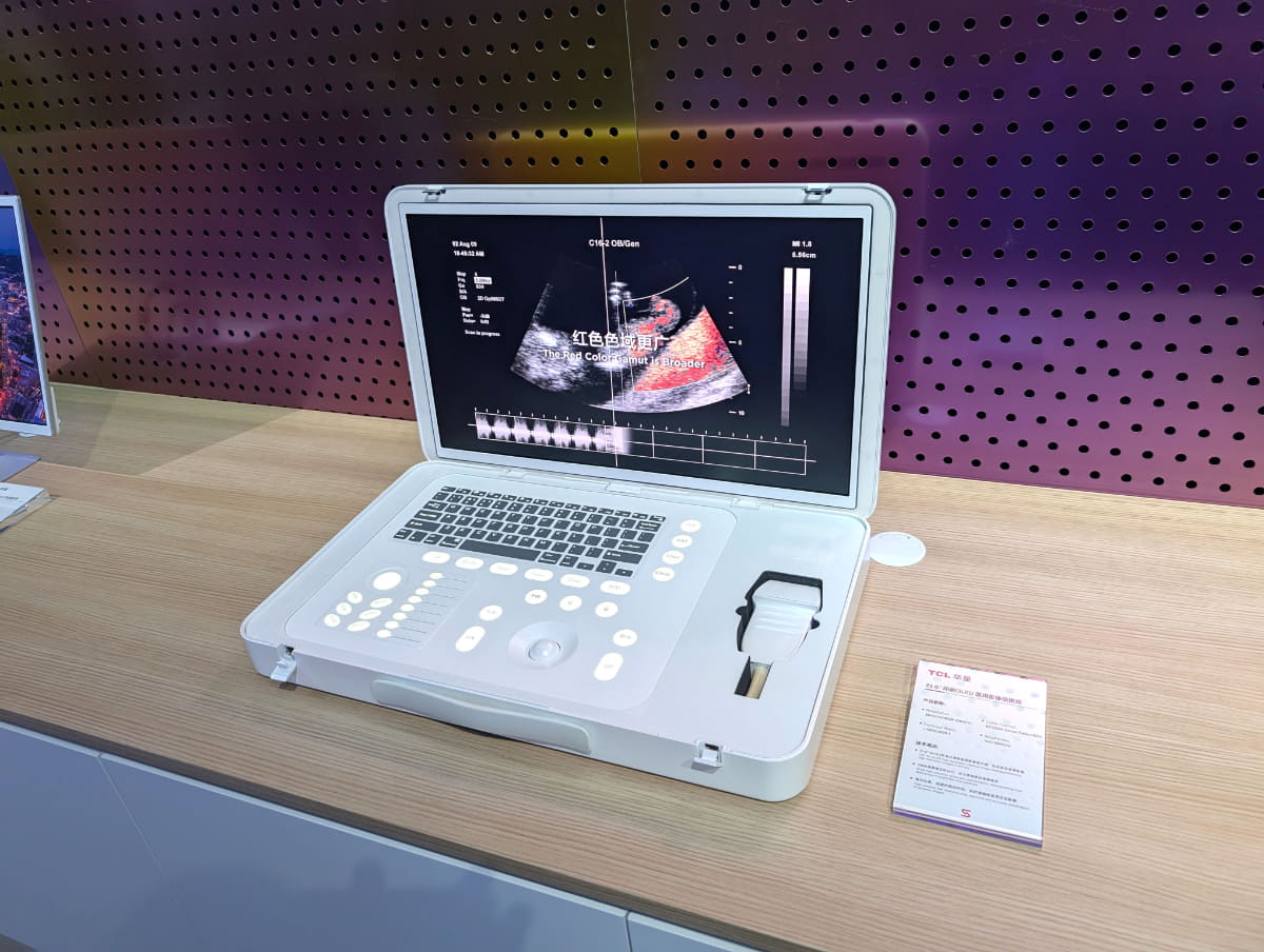 持ち運びが可能なポータブル型エコー検査システム。ディスプレイ部分に21.6型4K解像度の印刷OLEDパネルを使用している