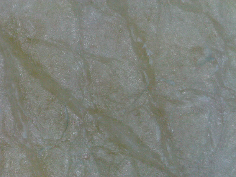 300倍。筆者の手の甲の皮膚。肌の肌理がよく見える