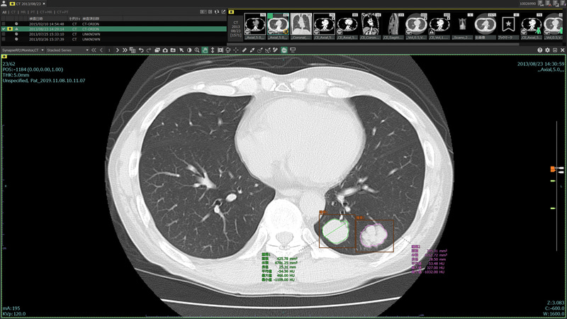 SYNAPSE SAI viewer V1.3：富士フイルム株式会社
