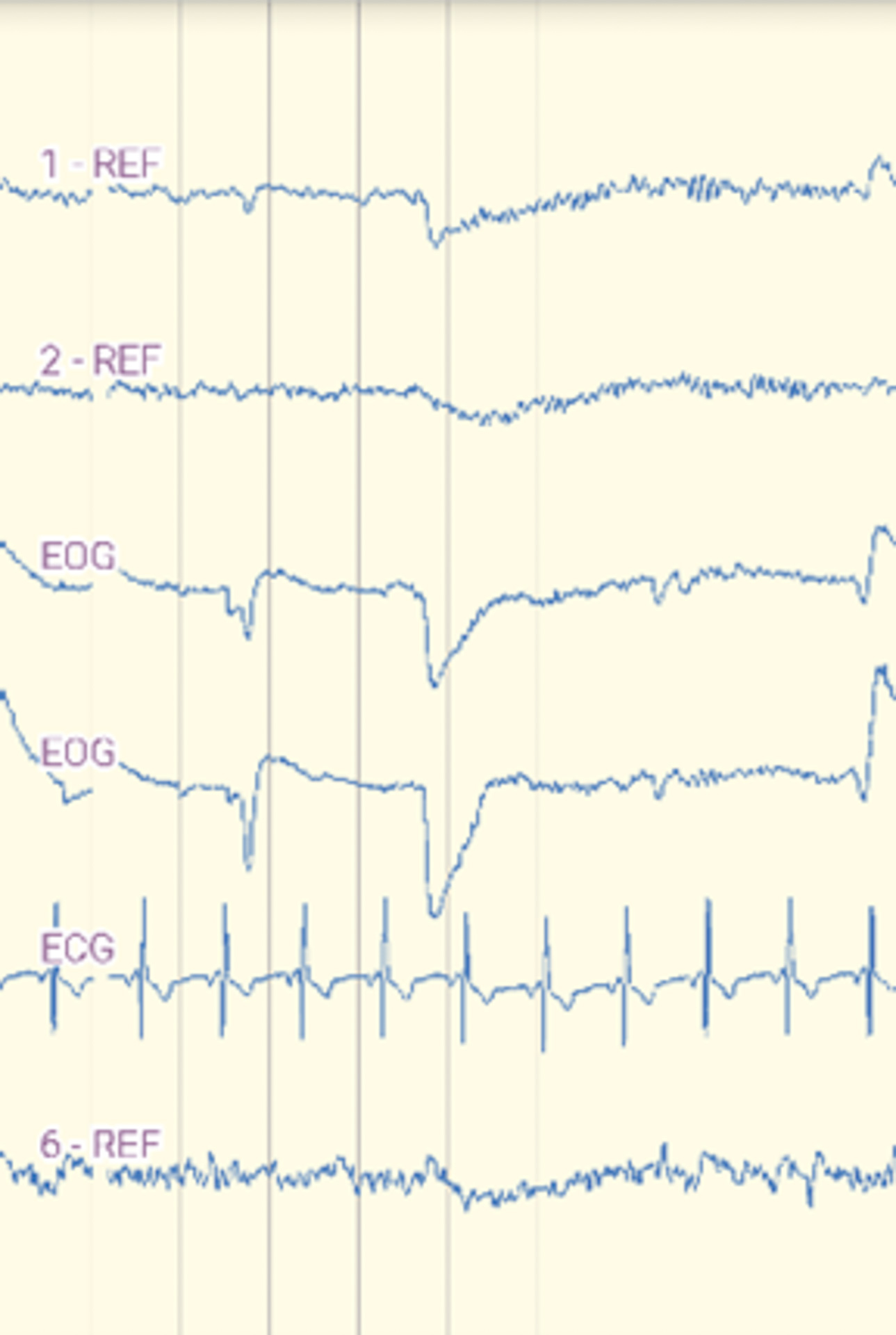 動画視聴中の脳波