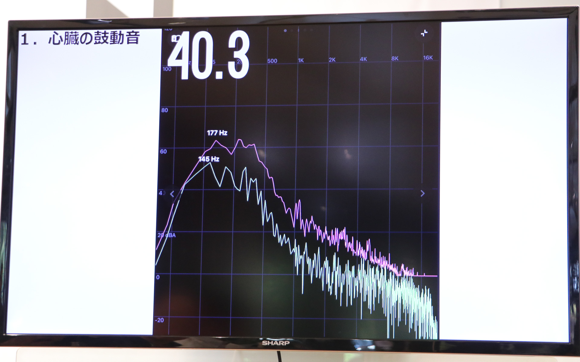 心臓の鼓動音の周波数
