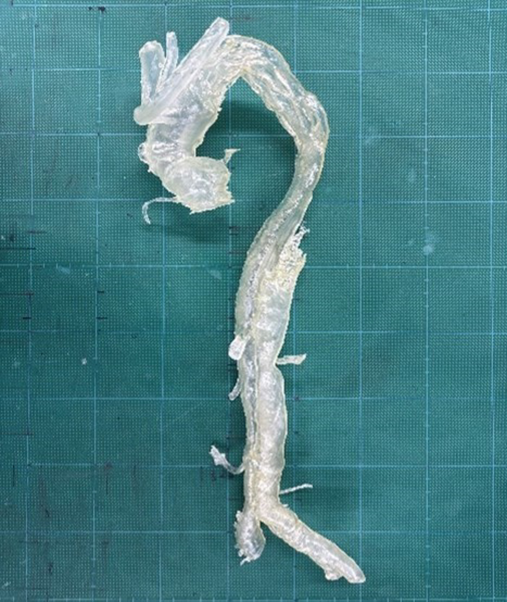 「大動脈血管モデルの3D造形」