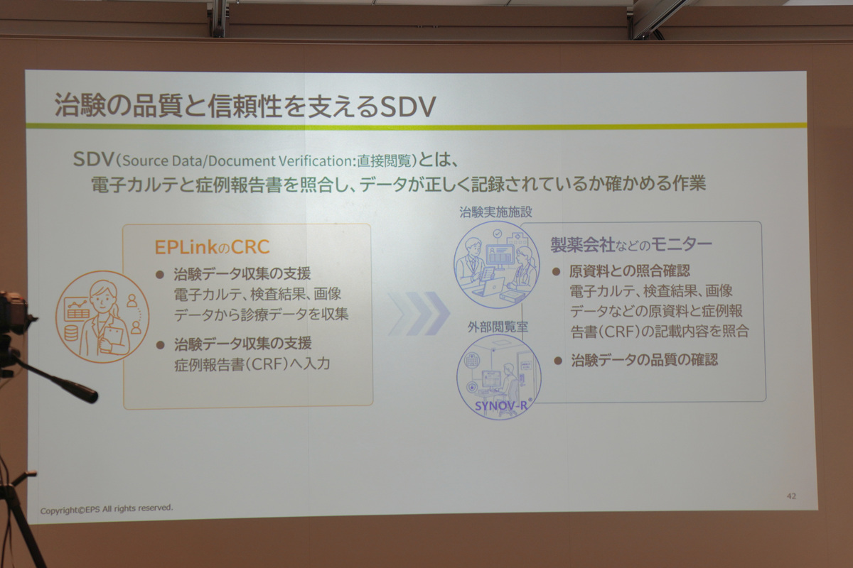 SDVとは