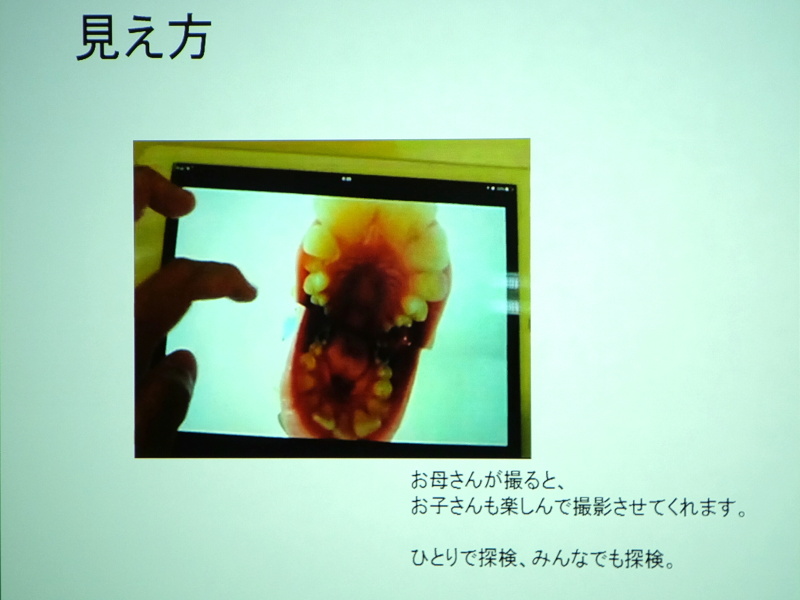 口腔内も明るく写る