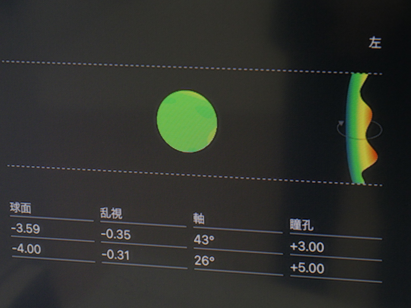 昼の状態（瞳孔が小さい）。写真レンズを絞り込むと収差が改善するかのように、眼の収差が目立たなくなった。つまり昼と夜では収差の出方が異なるため、どちらかだけを基準に最適な眼鏡レンズを設計するのは難しい、というのがツァイスの思想だ