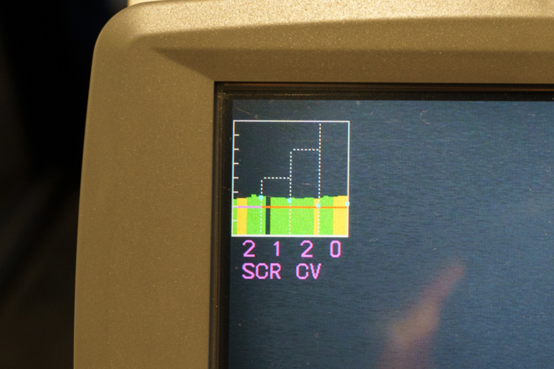 完全に老眼傾向の結果が出た