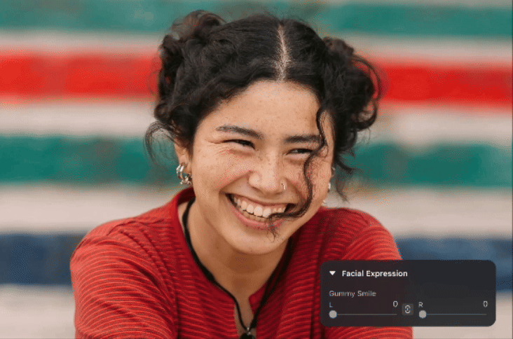 ガミースマイルの修正にも対応