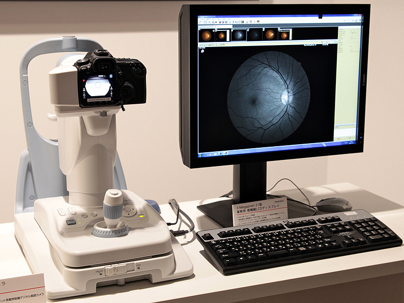 <b>CR-2での撮影例。ジョイスティックの上のボタンがシャッターになっている</b>