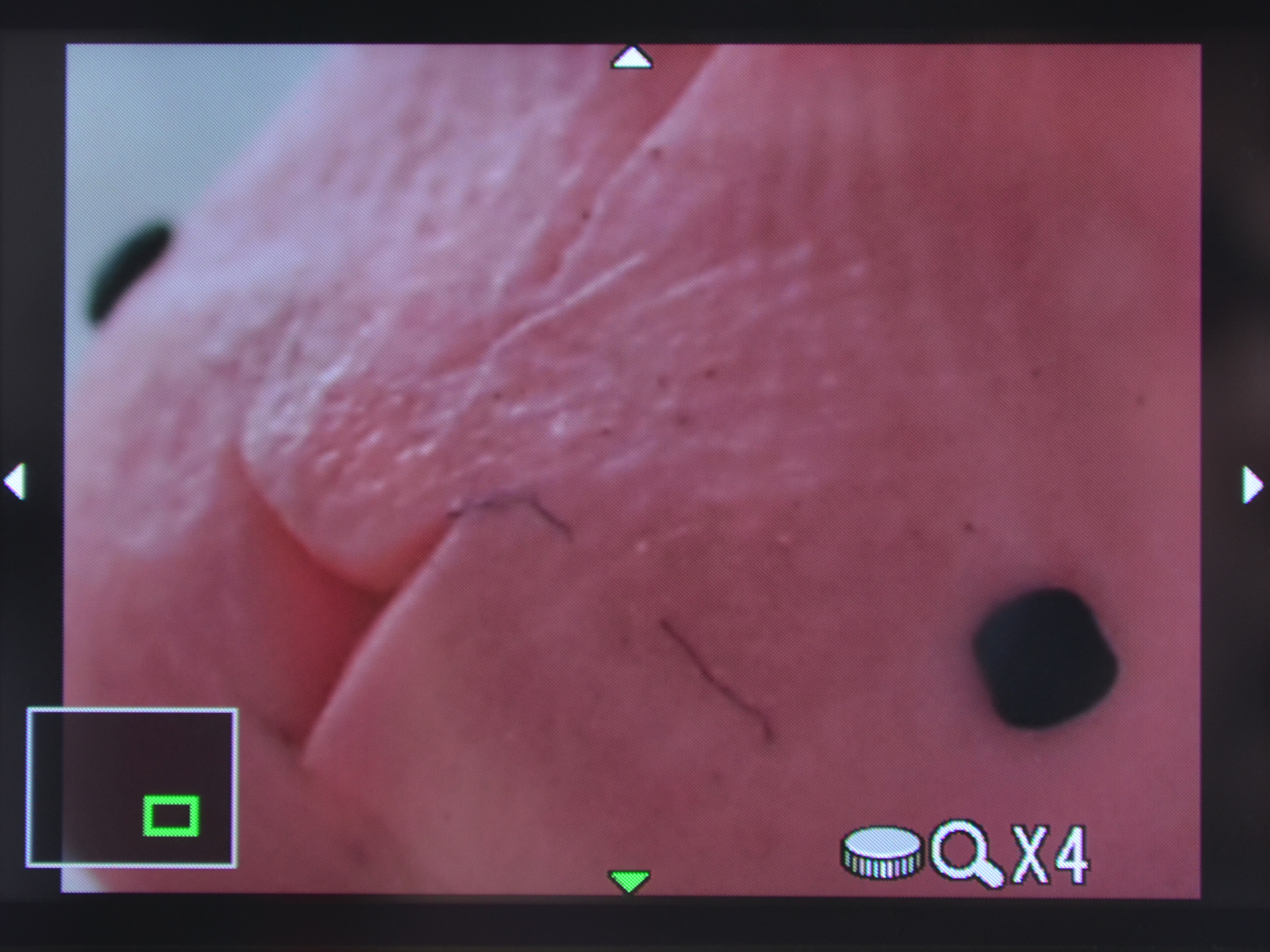 <b>まずは4倍表示でピントを合わせてから……</b>