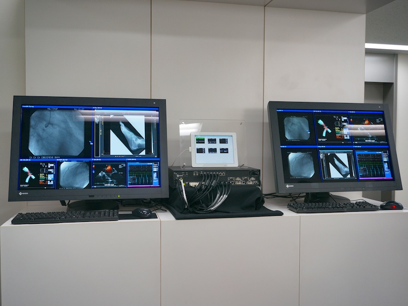 RadiForceシリーズの展示。中央下の黒い箱がスイッチャー。中央上のiPadは、モニターの切り替えに使用するという