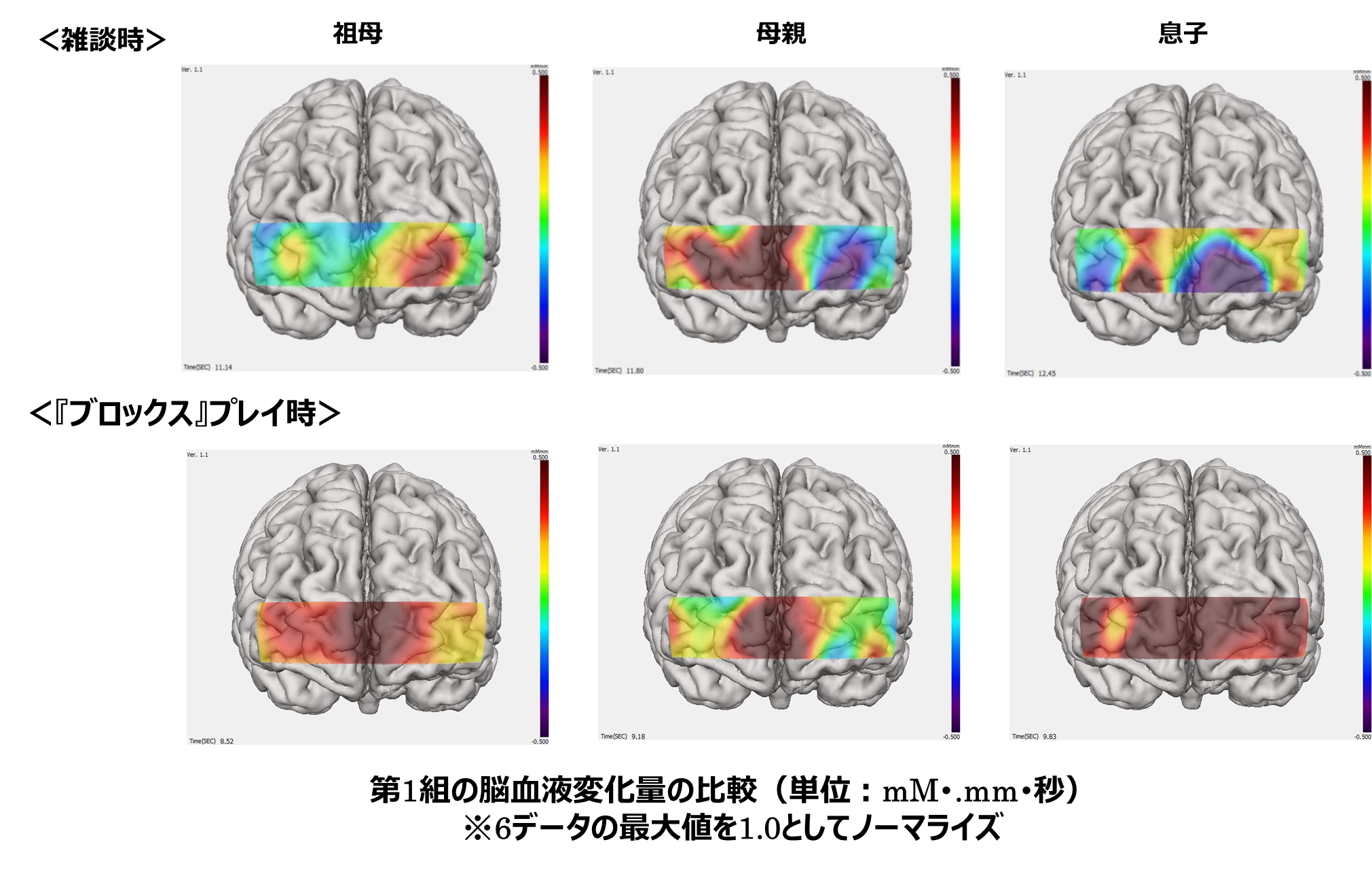 脳血液変化量の比較