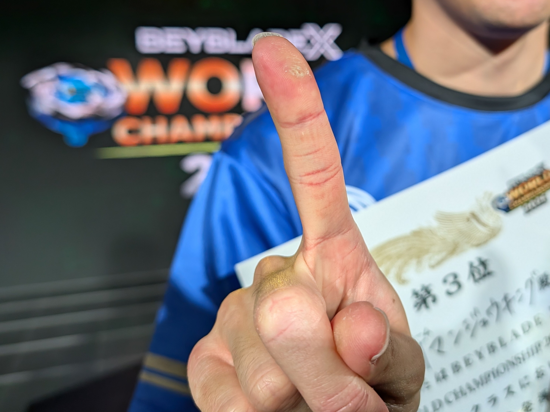 練習のし過ぎでマメのつぶれた後の人差し指を見せてもらう