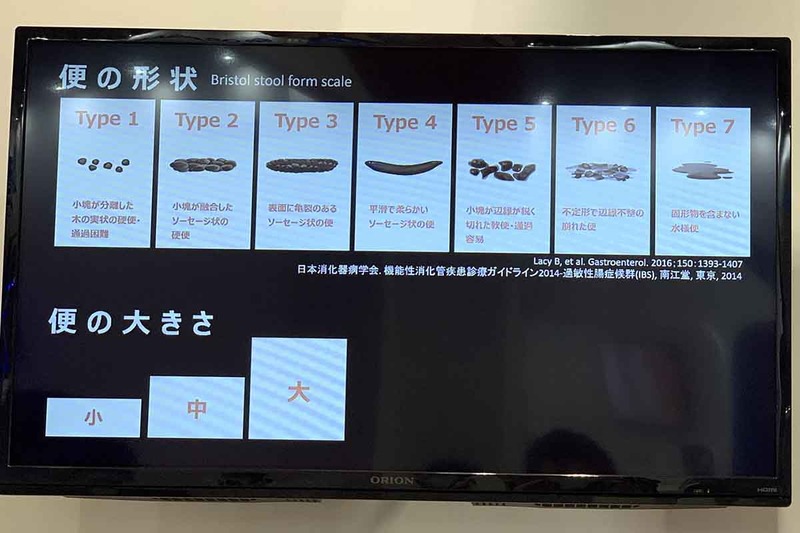 便器に備えたイメージセンサーで便の形や量などを判別