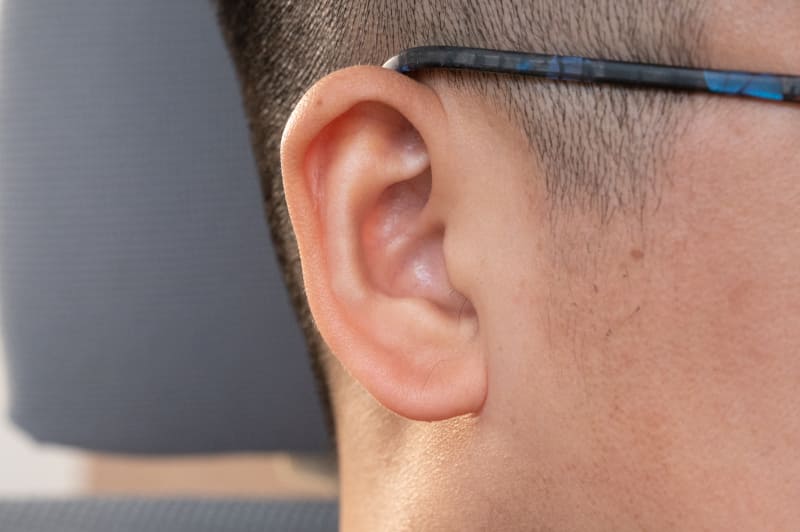 目立つタイプの耳毛。耳珠周辺だけでなく、耳たぶにも生えていた……