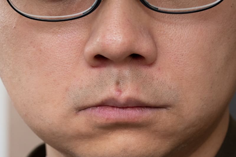 飛び出すタイプの鼻毛