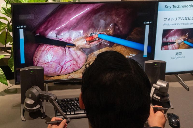 リアルなCGを使い、手術のシミュレーションが行なえる