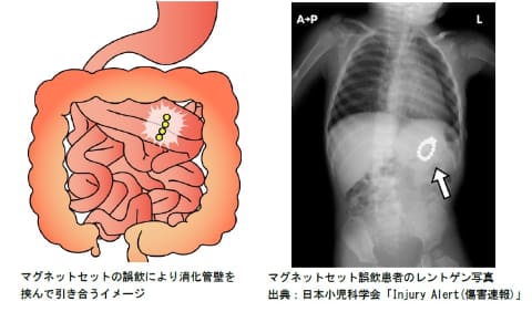 誤飲多数の「マグネットセット」販売不可に - Impress Watch