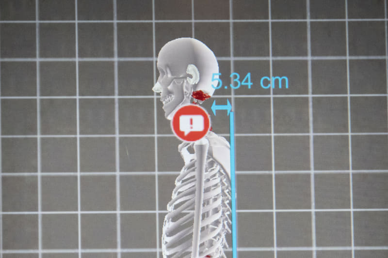 首の部分に枕の高さの目安が表示される(画面上部に表示されている年齢はダミーとなり、実際の年齢とは異なります)