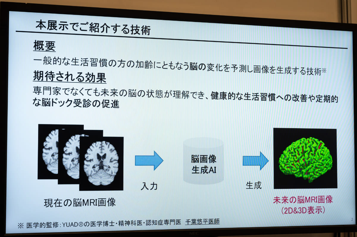 脳のMRI画像だけで将来を予測