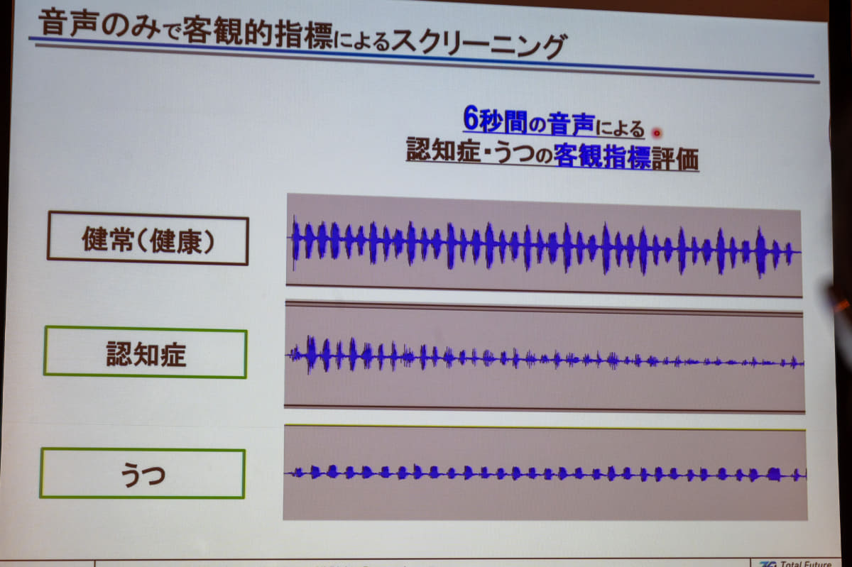 音声から声帯の状態を検知し健康状態を判定するPST