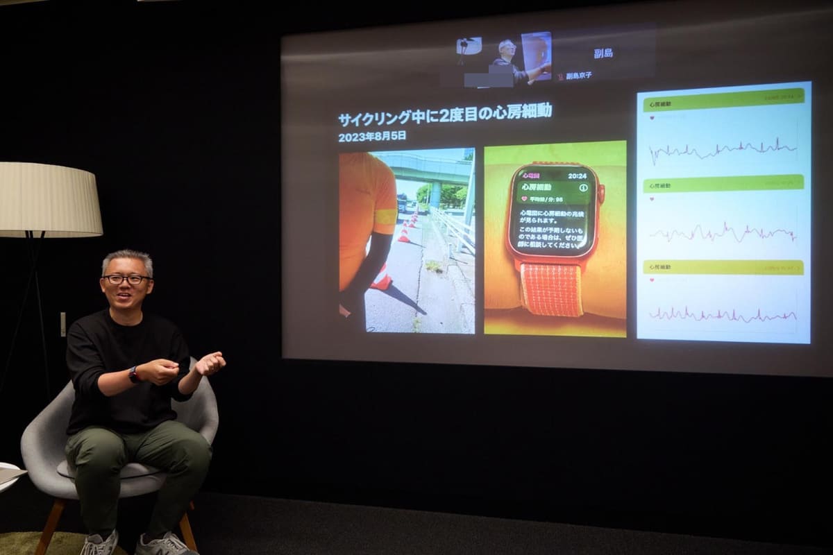 心房細動の兆候を知らせるApple Watchの画面や、心電図など