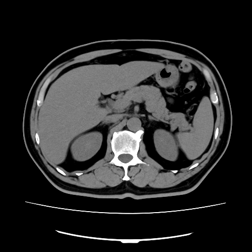 腹部CTの画像例(chocoZAP提供)