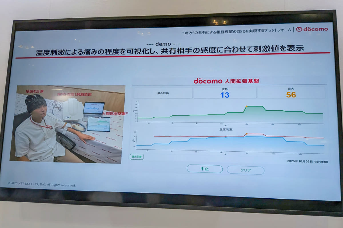 温度刺激による痛みの共有実験の様子。青が温度の変化、緑が被験者の温度刺激による痛みの感度、赤が共有相手に同じ痛みを与えるための温度の変化