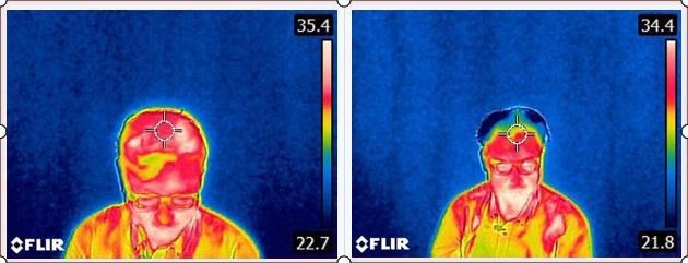 本機使用前(写真左)、使用後(写真右)。頭皮の温度が下がったことが分かる