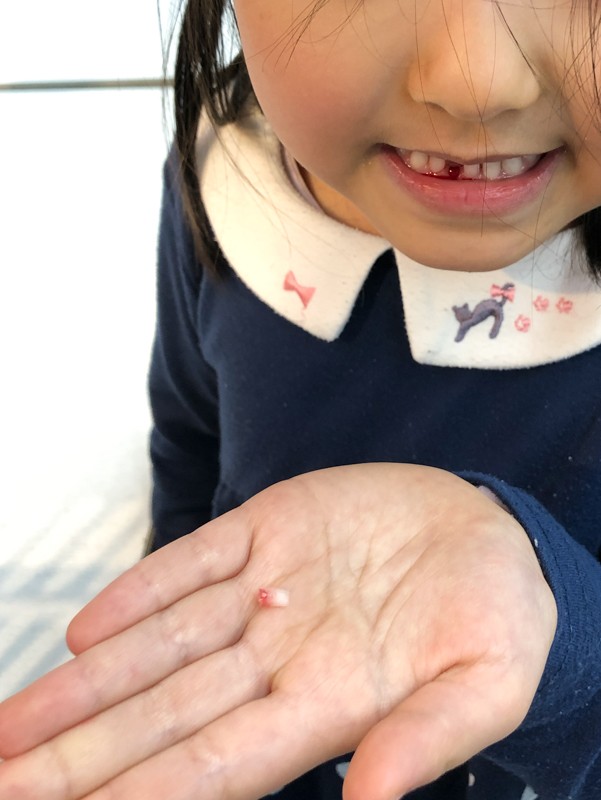 レジで歯が抜けた人はじめて見た