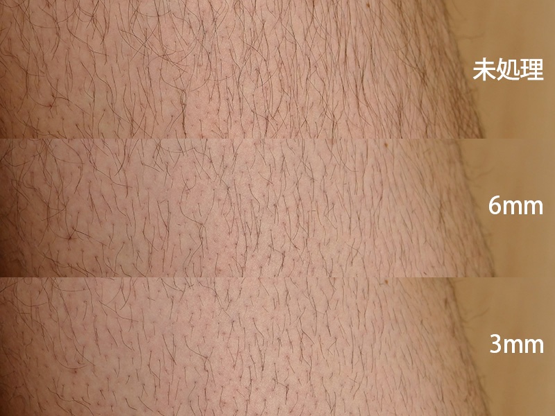 「刈り高さアタッチメント」は確実に長さ調整ができる。はじめは長めにカットして様子を見て好みの長さを決めるといいだろう