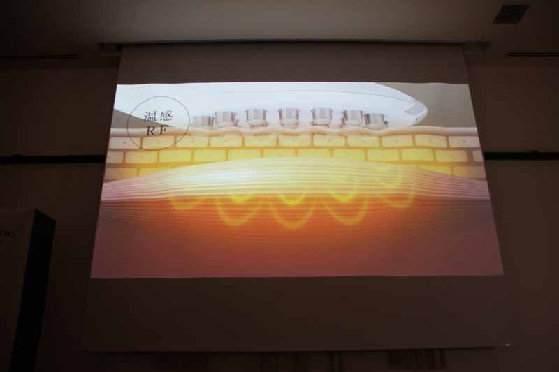 肌を内側から温める温感RF