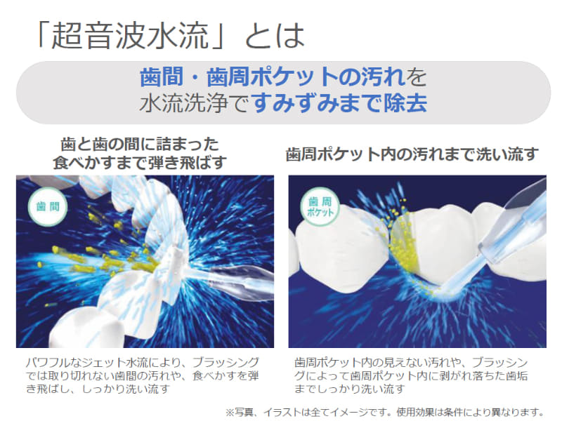 ジェットウォッシャー ドルツは独自の「超音波水流」で歯間の汚れを落とすのが特徴