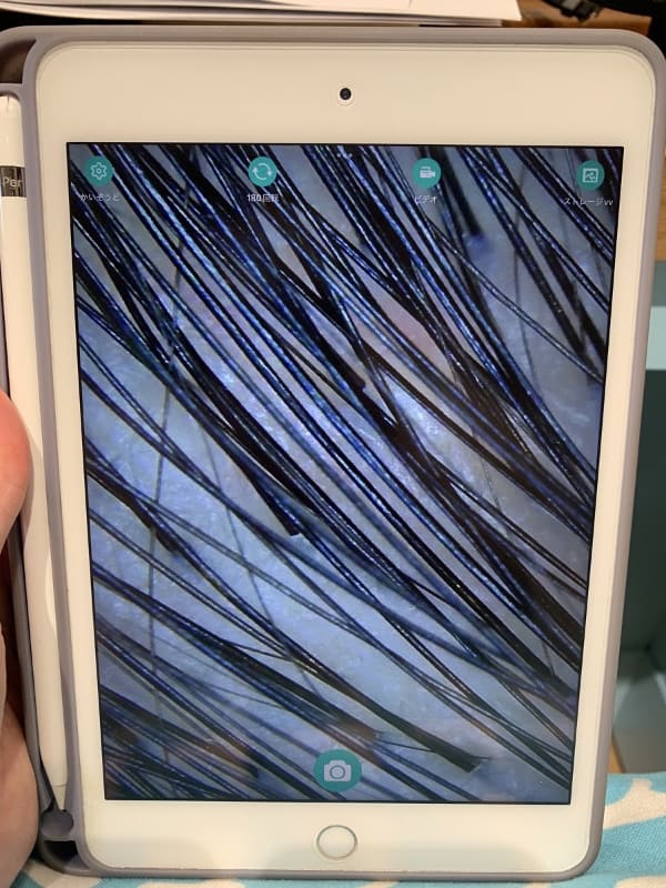 汚れがスッキリし、根元も立ち上がった