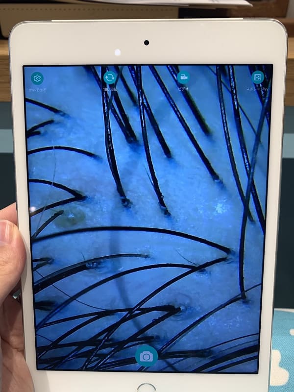 皮脂汚れが溜まっている