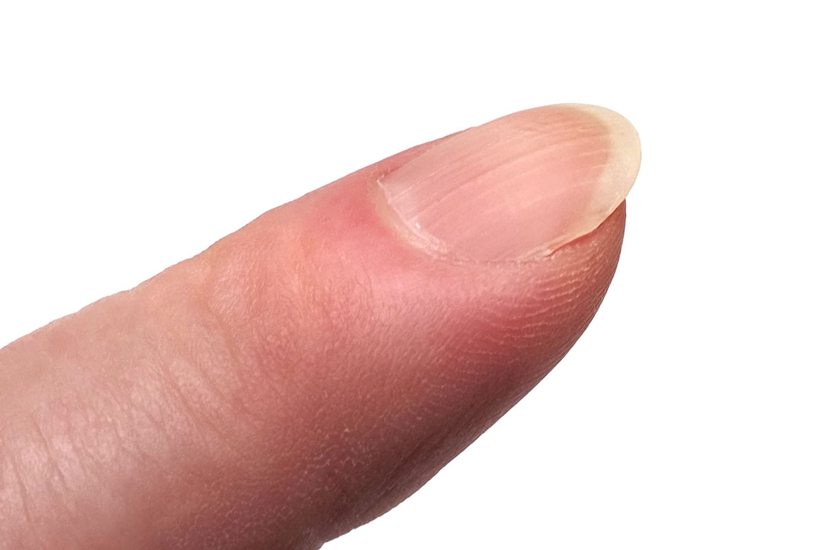 こちらは爪切り前の人差し指