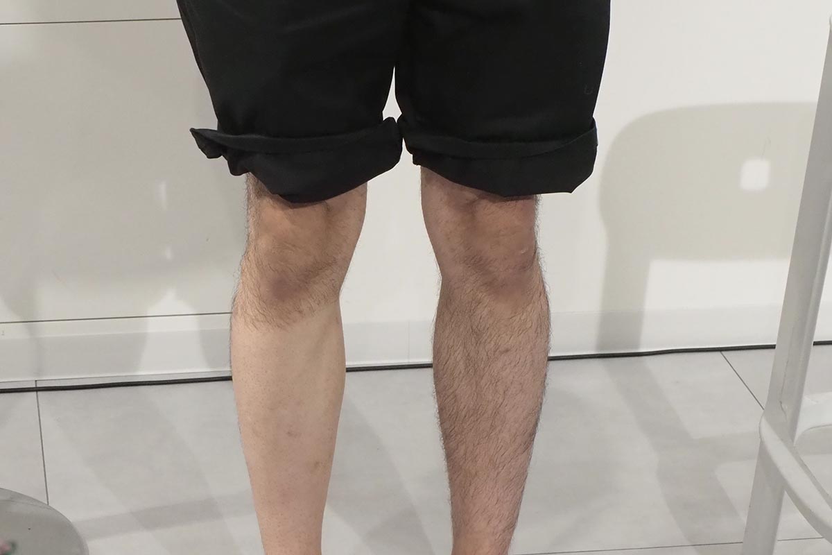 短時間のケアでもはっきり違いが出て、肌に傷なども見えなかった