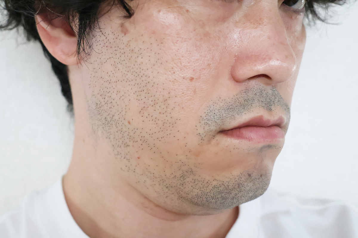 約1日ほど伸びたヒゲ