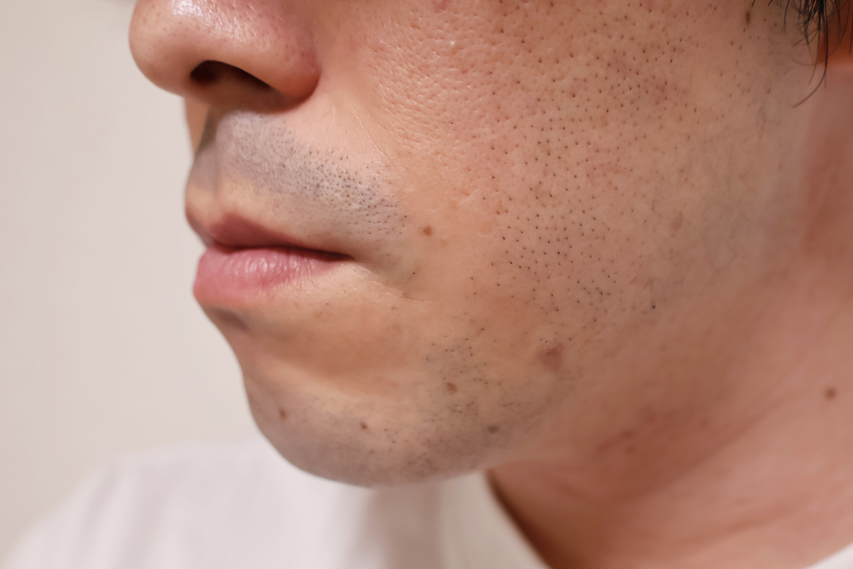 After。剃ったあと