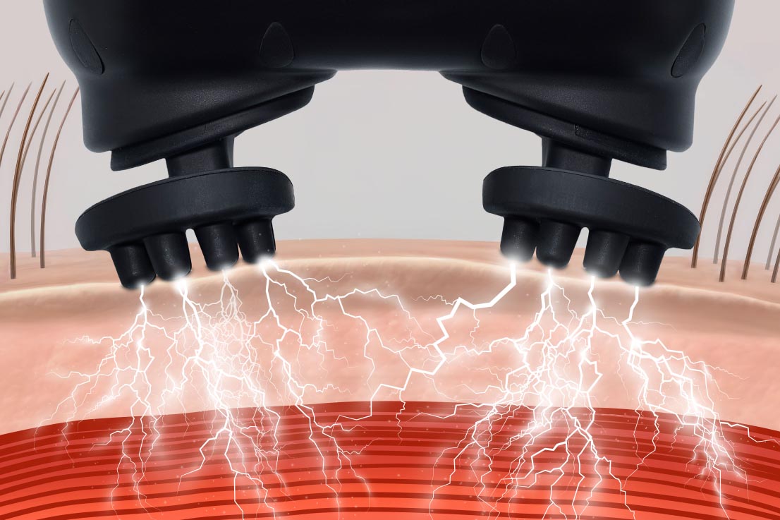 EMSでの刺激も加える