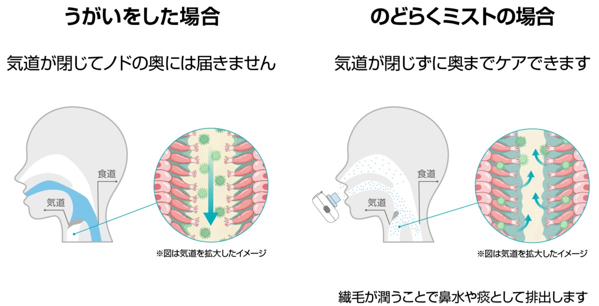 うがいでは届かない喉の奥までアプローチ