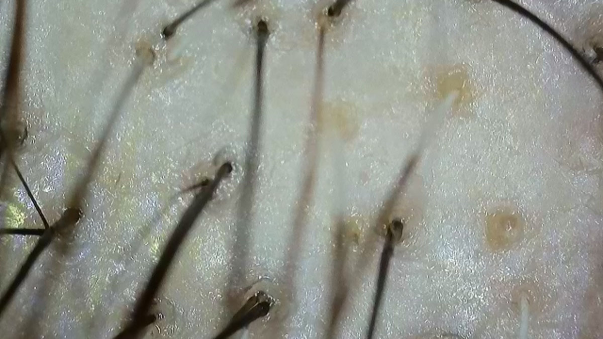 使用前