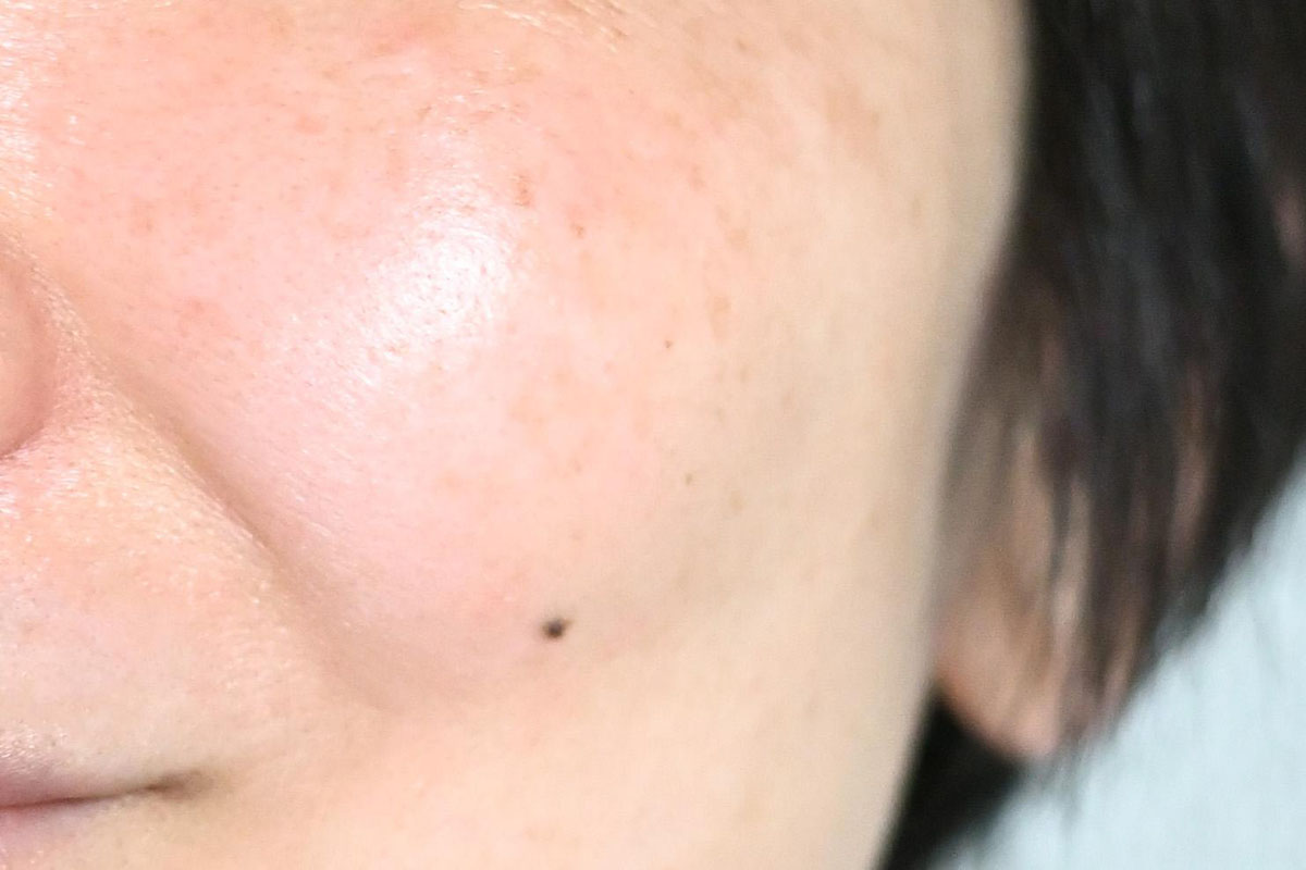 最近の肌。使い始めのときと全く同じ条件で撮影できず、比較ができないのですが、ハリツヤが「損なわれにくくなった」感じがします