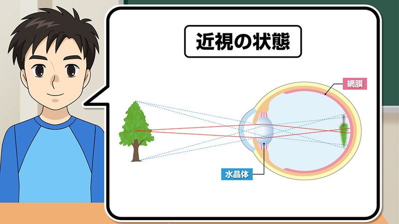 広島県教科用図書販売株式会社が、「近視のしくみと予防」と題した動画教材を公開（出典：広島県教科用図書販売株式会社）