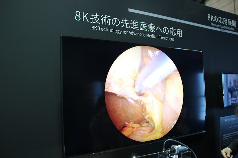 8K撮影が可能な内視鏡と組み合わせ、血管の細部を見ながら手術ができるシステム