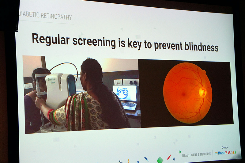 糖尿病患者への定期的な検査に機械学習を組み合わせて失明予防に繋げる