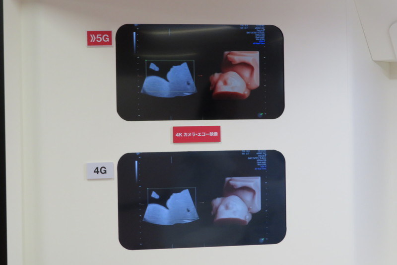 伝送されるエコー画像