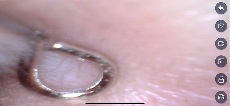 マイクロスコープは130万画素でピントは固定。カメラ先端から約1.4～2cmの範囲でピントが合います。カメラ先端に6個のLEDライト（無段階調光対応）を内蔵。耳かき（イヤーピック）は金属製とプラスチック製が2個ずつ付属し、これらをマイクロスコープ先端に装着して使います。耳かきを外せばマイクロスコープとして使用可能。Wi-Fi/電源モジュール部は2時間で満充電になりますが、連続使用時間の公称値は不明。Wi-Fi/電源モジュール部にUSB給電しながら使うこともできます。なお、Wi-Fi/電源モジュール部裏面には「技適マーク」があり、日本国内にて合法的で使うことができます。右の写真はiPhoneで専用アプリを使って耳のなかを見ている様子です。