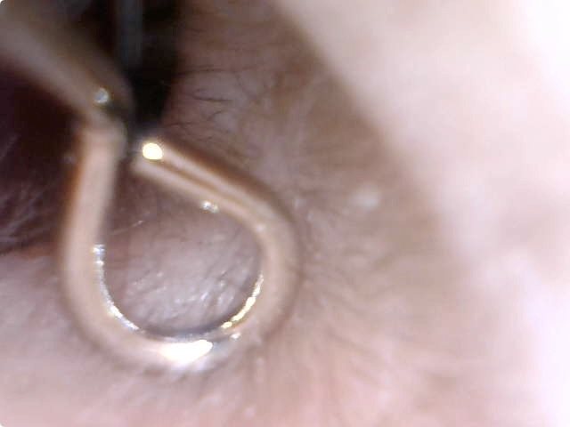 耳の穴へイン！　右の耳です。ピントが合う範囲なら、耳のなかのうぶ毛などもけっこうよく見えます。