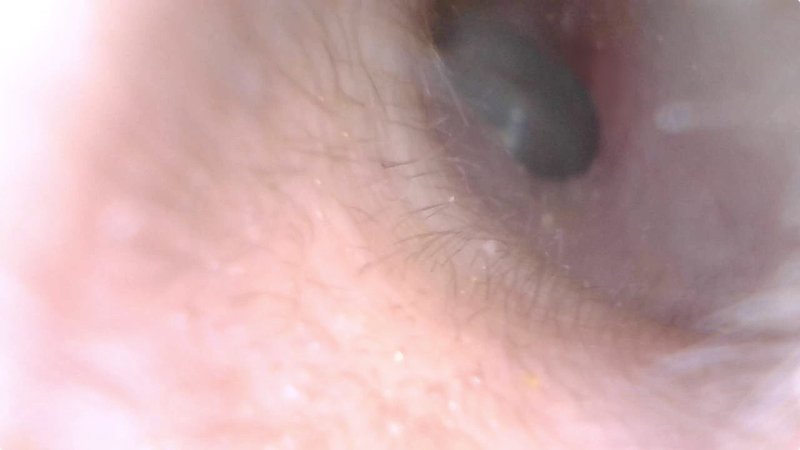 QuickTime Playerで撮った動画を切り出しています。QuickTime Playerでは1280×720の解像度で撮れていました。耳かき部分を取り、しかも高解像度だと、より耳のなかが見やすいです。ちなみに、これは左耳。